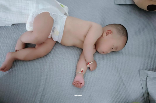 宁波六个月宝宝眼睛散光